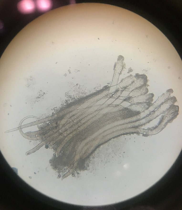دمودکس زیر میکروسکوپ | آنجکس